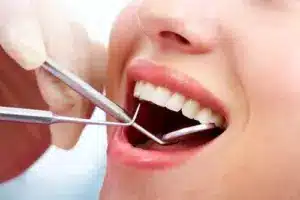 Oral Health Treatment in Gurgaon