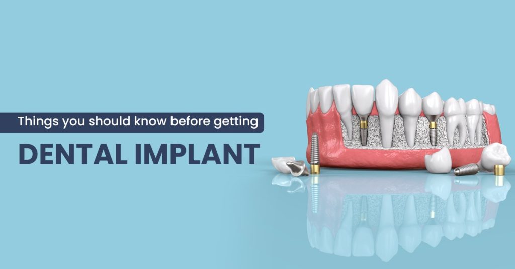 dental implant pain