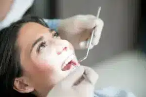 Tooth Cleaning Treatment in Gurgaon