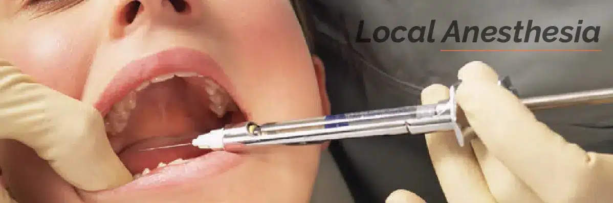 Local Anesthesia For Dental