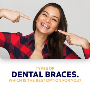 Types Of Dental Braces