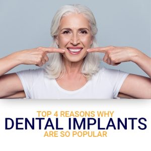 Reasons Why Dental Implants Are So Popular