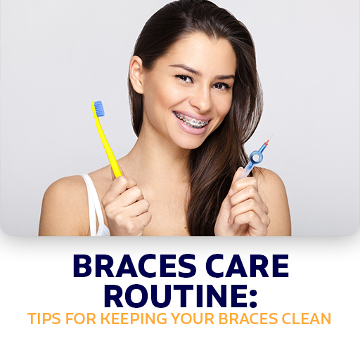 Braces Care Routine-Tips For Keeping Your Braces Clean