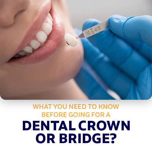 Need to Know Before Going For A Dental Crown Or Bridge