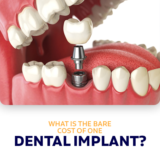What is the bare cost of one dental implant