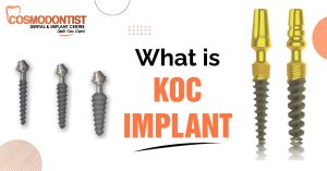What is KOC Implant