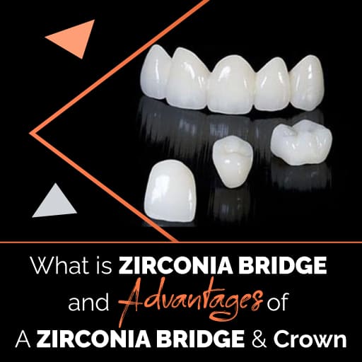 Cosmodontist zirconia bridge