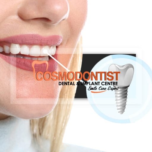 Dental Implant Cost in Gurgaon India