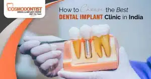 How to choose best dental implant clinic in India
