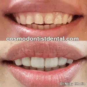 Cosmetic Dentistry Image 