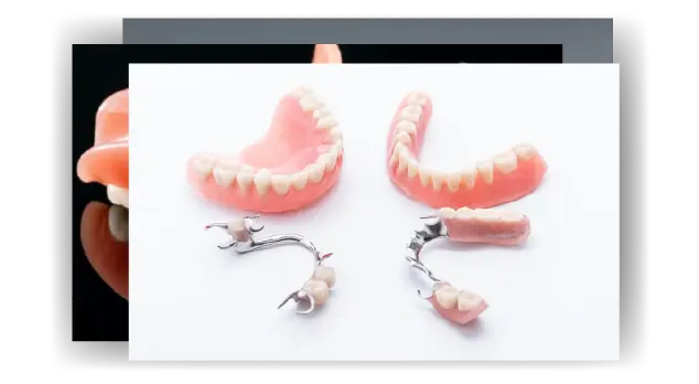 Implant-Retained Denture Process