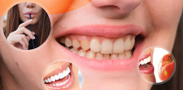 Steps To prevent yellow teeth