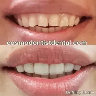 Cosmetic Dentistry Image 